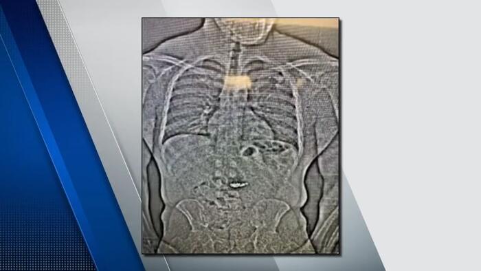 Florida man found guilty of robbery after swallowing stolen jewelry from Tiffany...