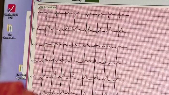 Free heart screenings available Sunday for teen athletes in Missouri City