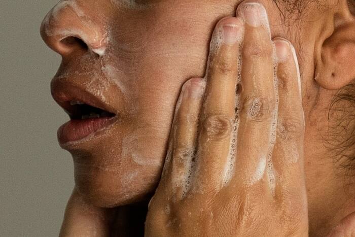 Adult acne affects workforce and requires professional treatment