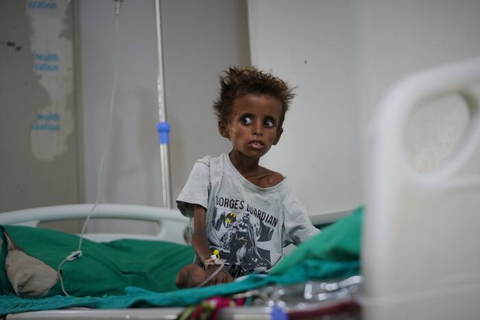 Yemen’s civil war returns and overwhelms hospitals with ‘a very dangerous situation’