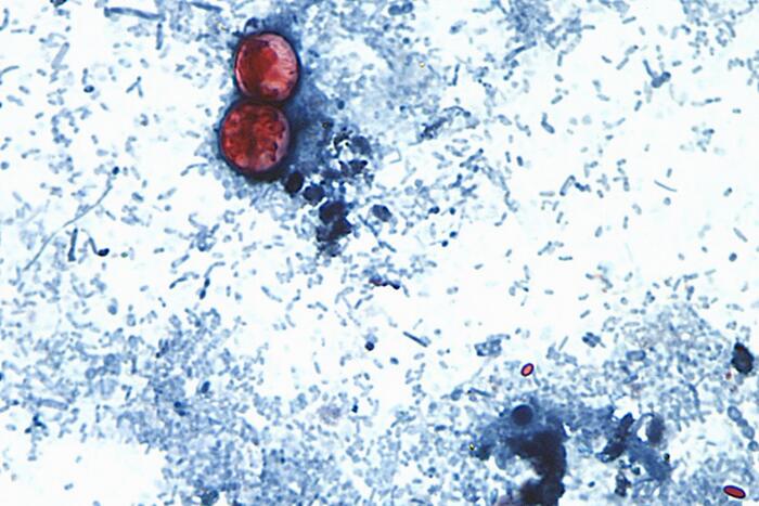 Cyclospora parasite found at Mexican farm linked to lettuce outbreak