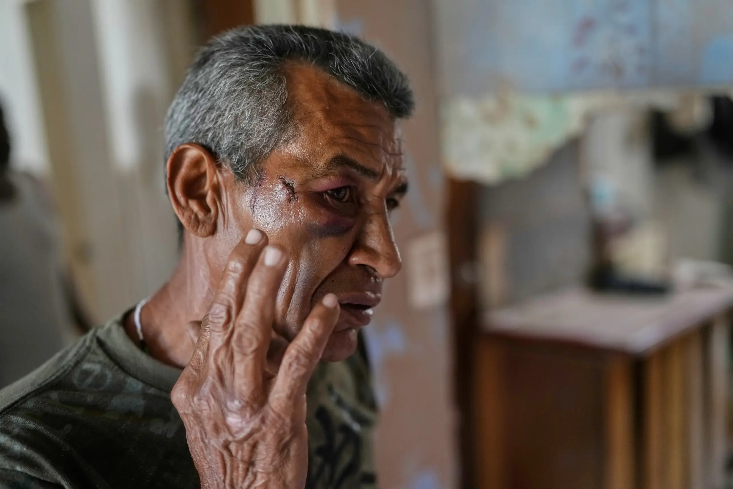Trepdiation 'Still shaken': Trepidation in Venezuela after US captures Maduro