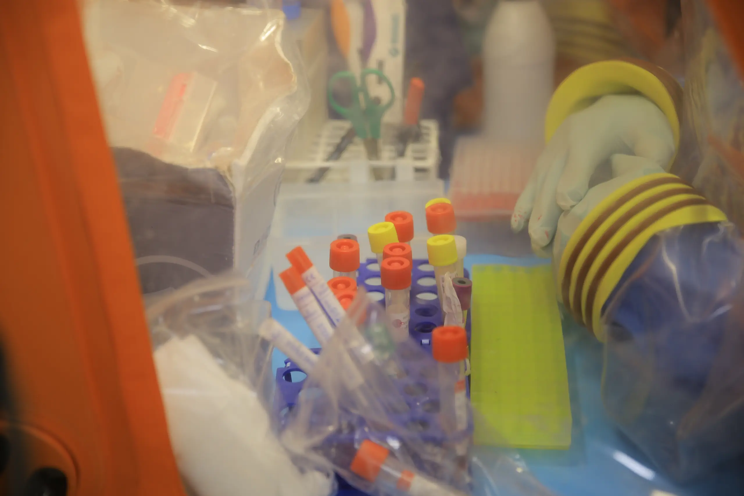 DR Congo’s Confirmed Ebola Cases Surpass 9,000 as Containment Efforts Struggle